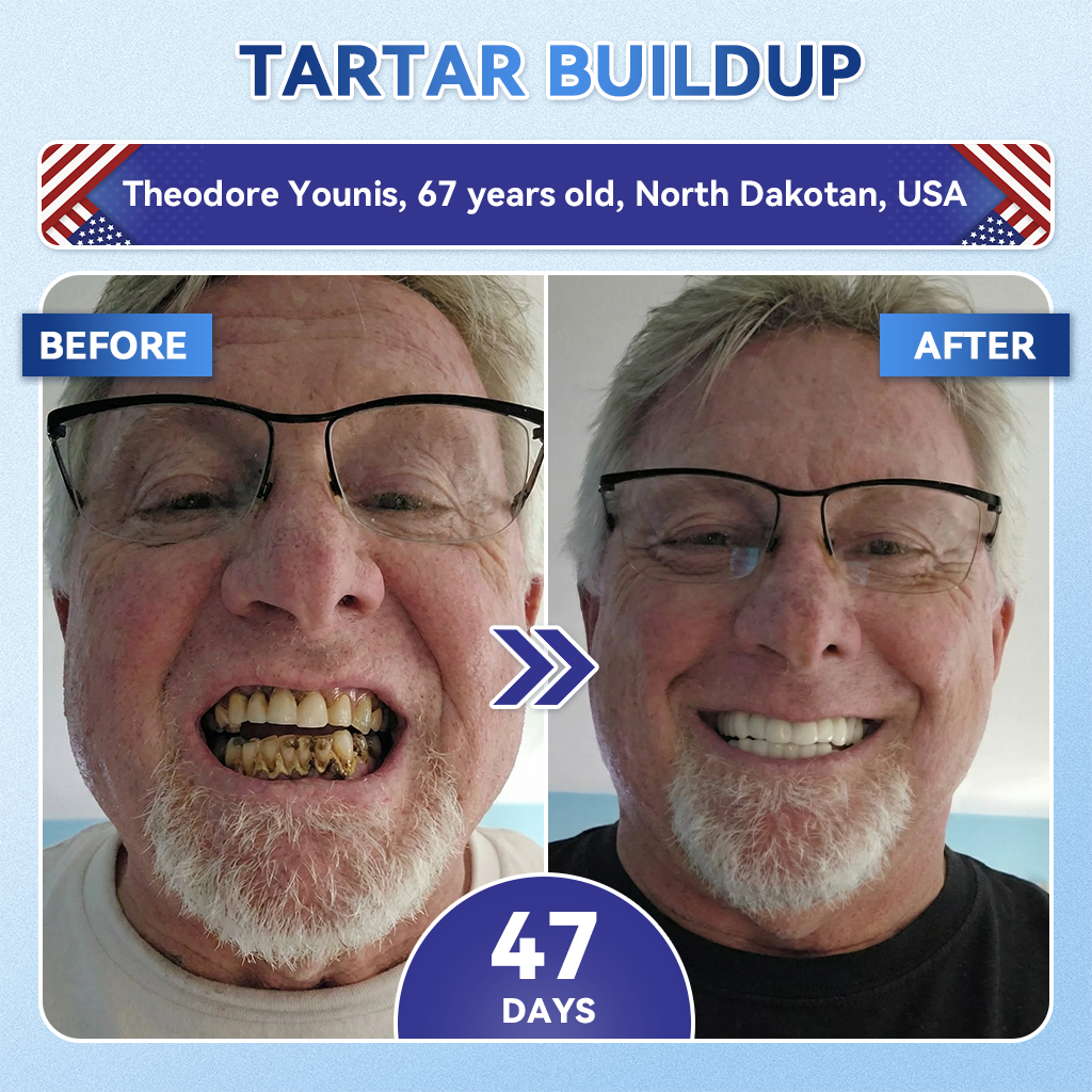 DarkFairy® 🦷 Tideglusib Fast‑Dissolving Tooth & Gum Repair Oral Strips ✨