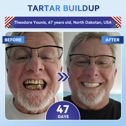 DarkFairy® 🦷 Tideglusib Fast‑Dissolving Tooth & Gum Repair Oral Strips ✨