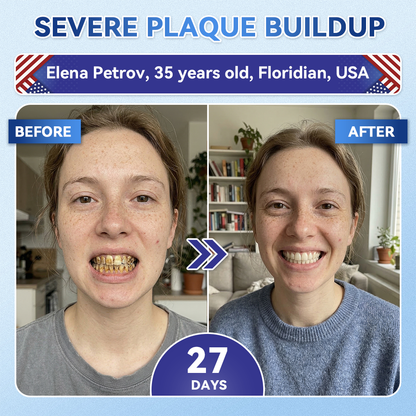 DarkFairy® 🦷 Tideglusib Fast‑Dissolving Tooth & Gum Repair Oral Strips ✨