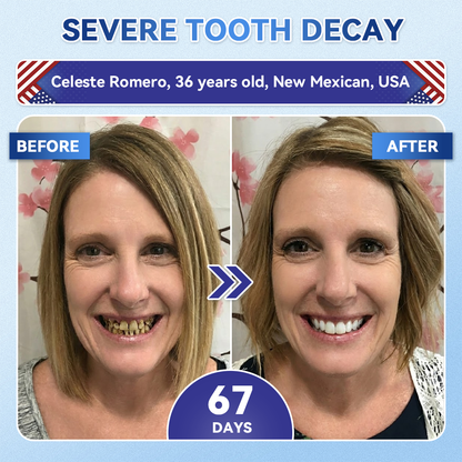 DarkFairy® 🦷 Tideglusib Fast‑Dissolving Tooth & Gum Repair Oral Strips ✨