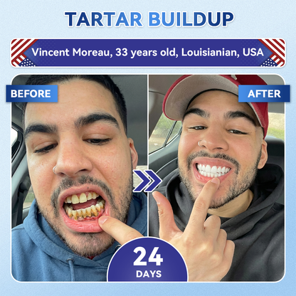 DarkFairy® 🦷 Tideglusib Fast‑Dissolving Tooth & Gum Repair Oral Strips ✨